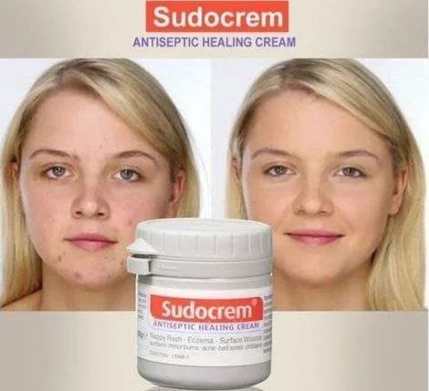 sudocrem كريم مضاد للالتهاب من سودوكريم